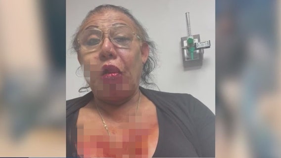 $10,000 reward offered in investigation of transgender woman attacked 6 times in LA