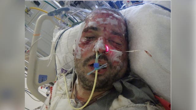 LA General Medical Center seeks help identifying patient
