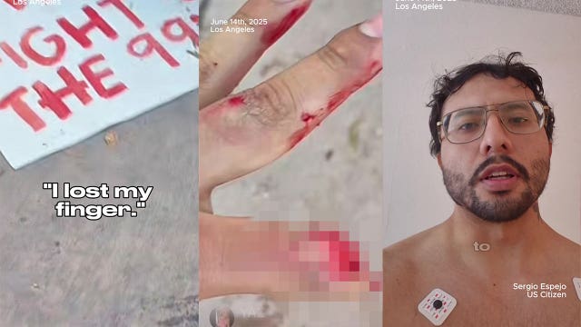 LA man sues LASD, alleging flashbang injury at "No Kings protest" led to amputation