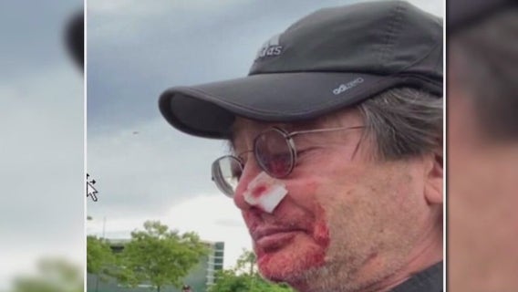 Man shot in face at George Floyd protest wins $3.8M from LA County