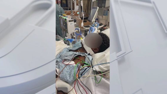 Lawsuit against LAPD alleges officers intentionally struck teen with police cruiser