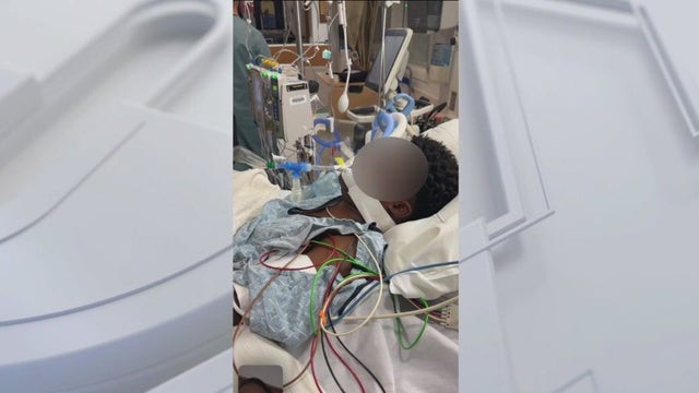 Lawsuit against LAPD alleges officers intentionally struck teen with police cruiser