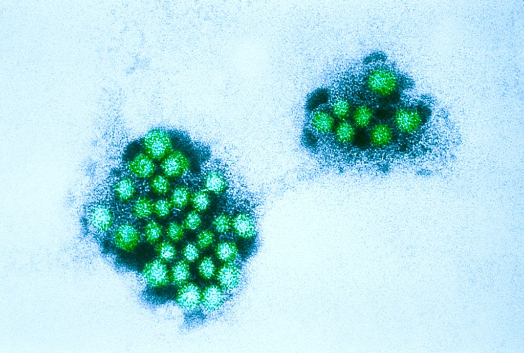 Norovirus cases spiking in California: What to know about 'winter vomiting bug'