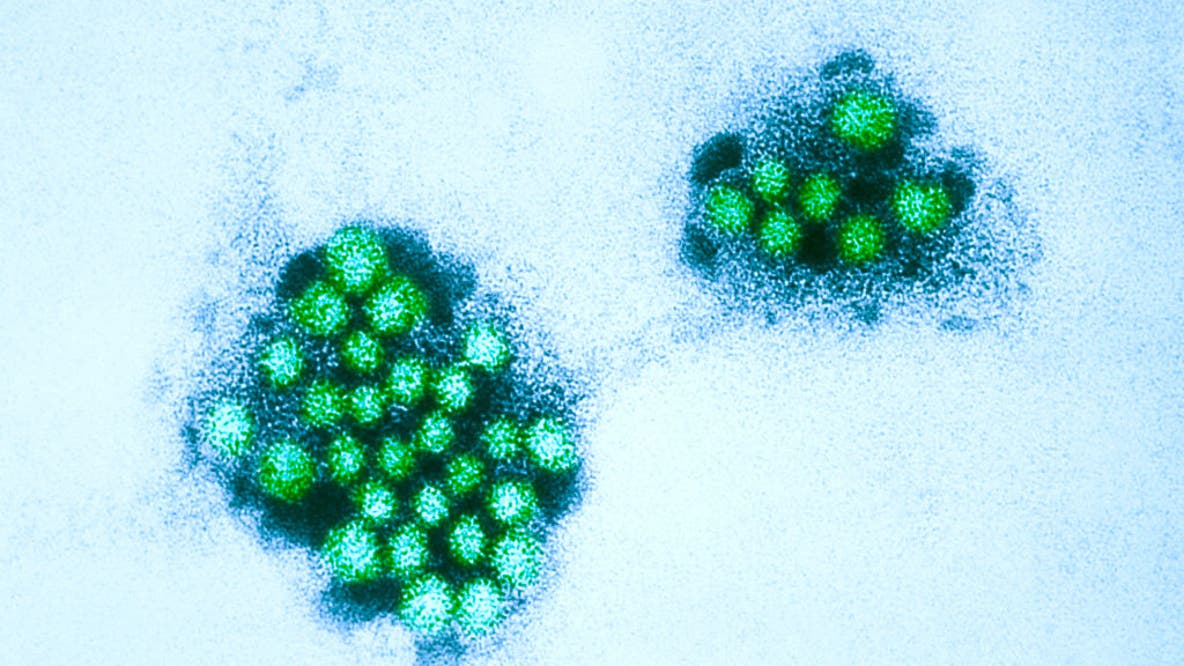 Norovirus cases spiking in California: What to know about 'winter vomiting bug'