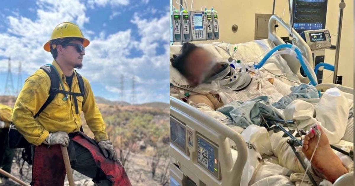 LA firefighter survives life-altering crash after car plummets off 800 ...