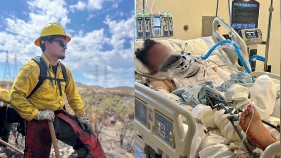 LA firefighter survives life-altering crash after car plummets off 800-foot cliff