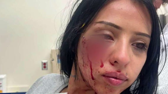 Woman sues LAPD after being shot in the face with paint projectile launcher during anti-ICE protest