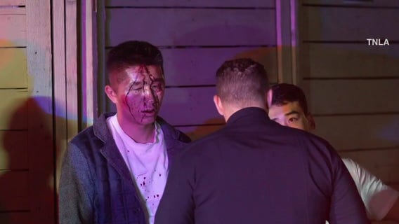 2 men brutally beaten in targeted Sun Valley auto shop attack; 2 cars stolen