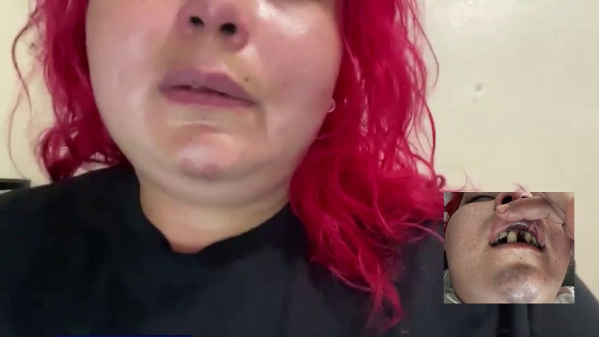 Mom of 2 says she was beaten, robbed after leaving a restaurant's World Cup watch party in Long Beach