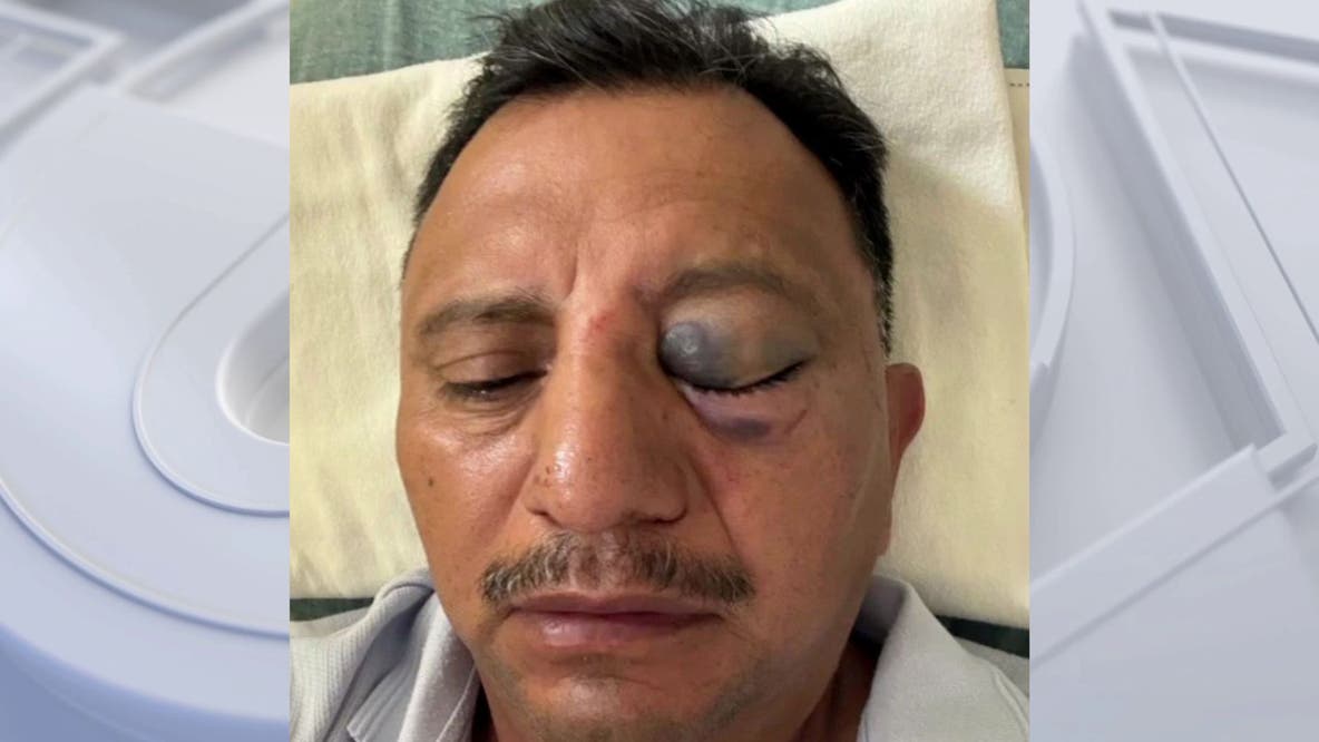Long Beach paletero says he was brutally attacked while selling ice cream on July 4