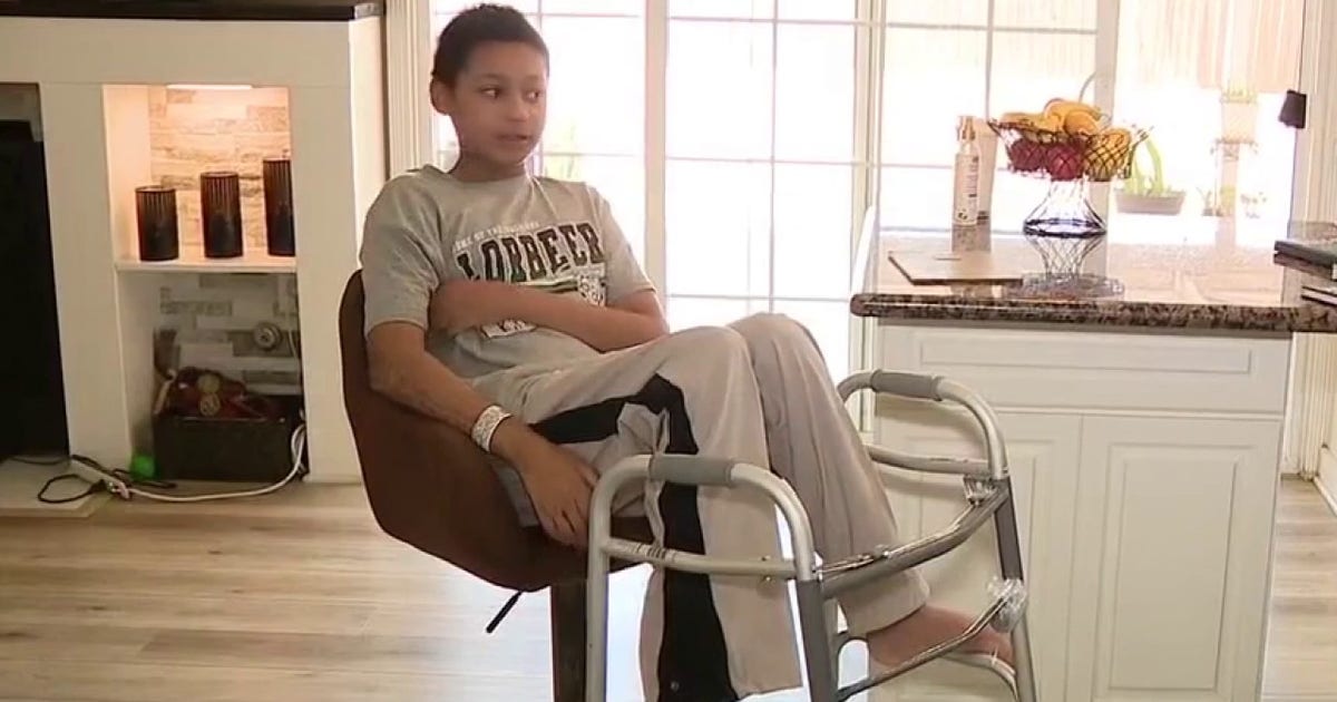 California teen recovering from severe burns after house fire needs help with rehabilitation