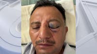 Long Beach paletero says he was brutally attacked while selling ice cream on July 4