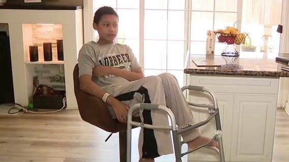 California teen recovering from severe burns after house fire needs help with rehabilitation