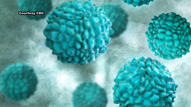 Cyclosporiasis outbreak possibly tied to salad greens, lettuce, MDHHS says