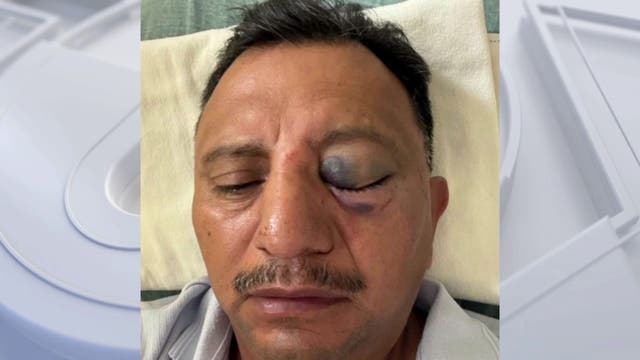 Long Beach paletero says he was brutally attacked while selling ice cream on July 4