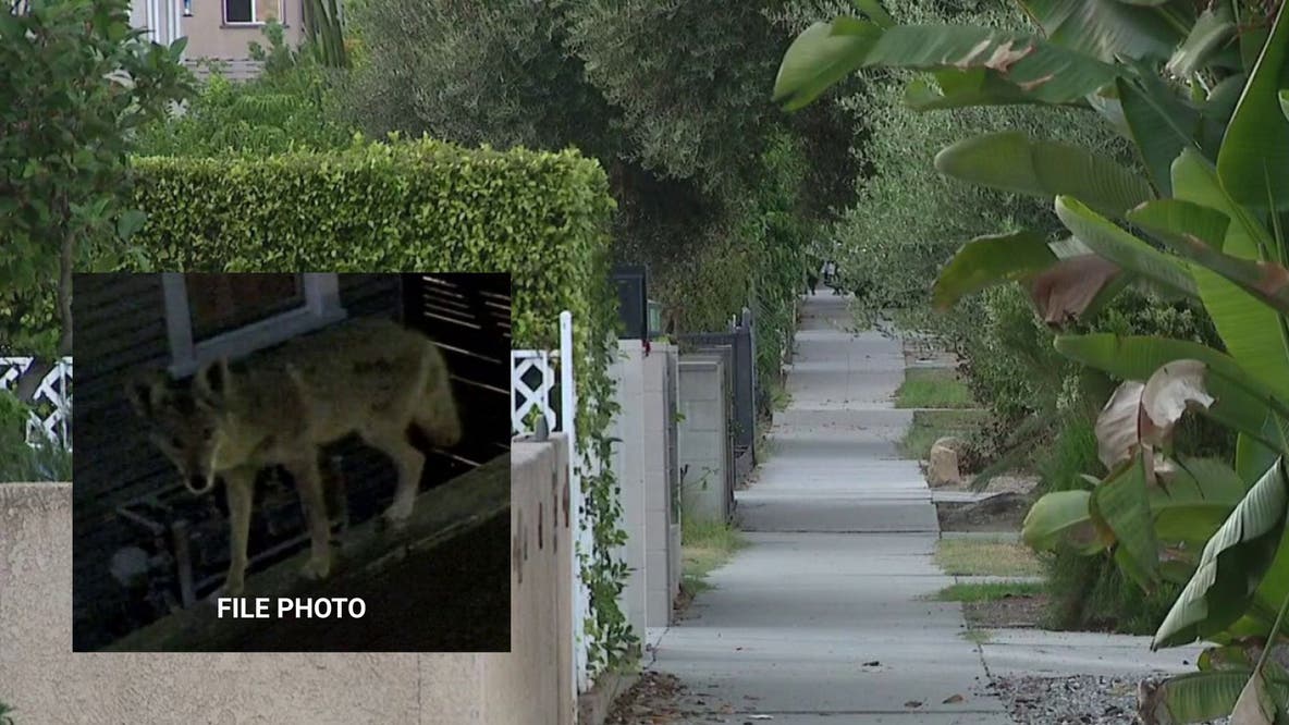 Atwater Village toddler attacked by coyote; DNA testing underway