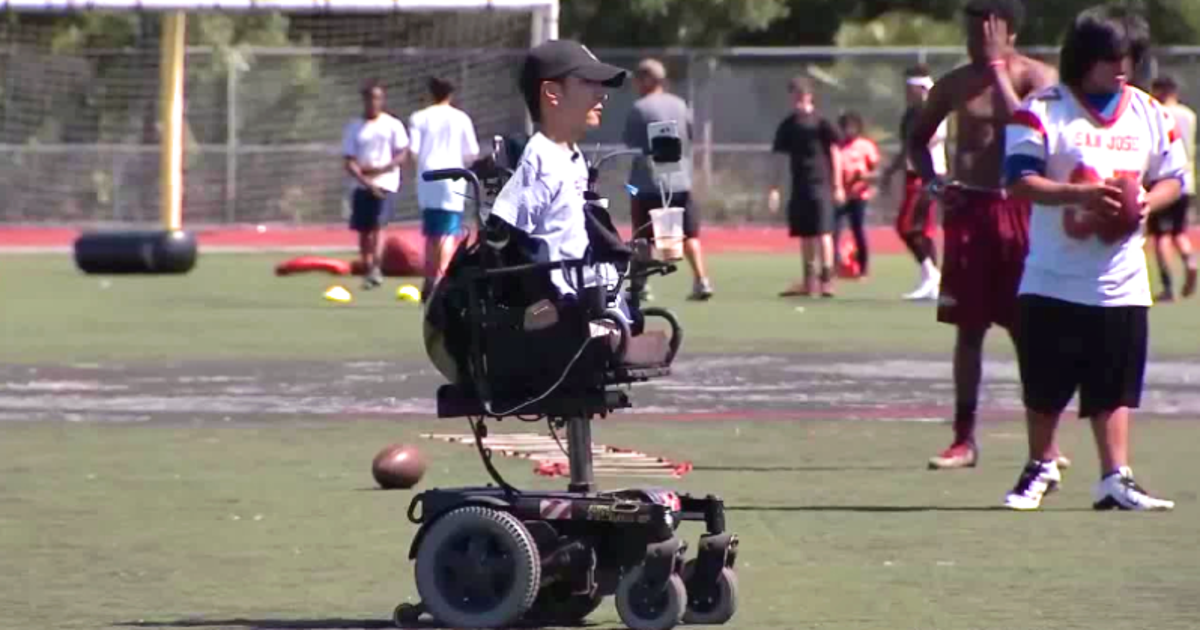 Bay Area Football Coach Born Without Arms Or Legs Named ESPY Award Bay Area Football Coach Born Without Arms Or Legs Named ESPY Award
