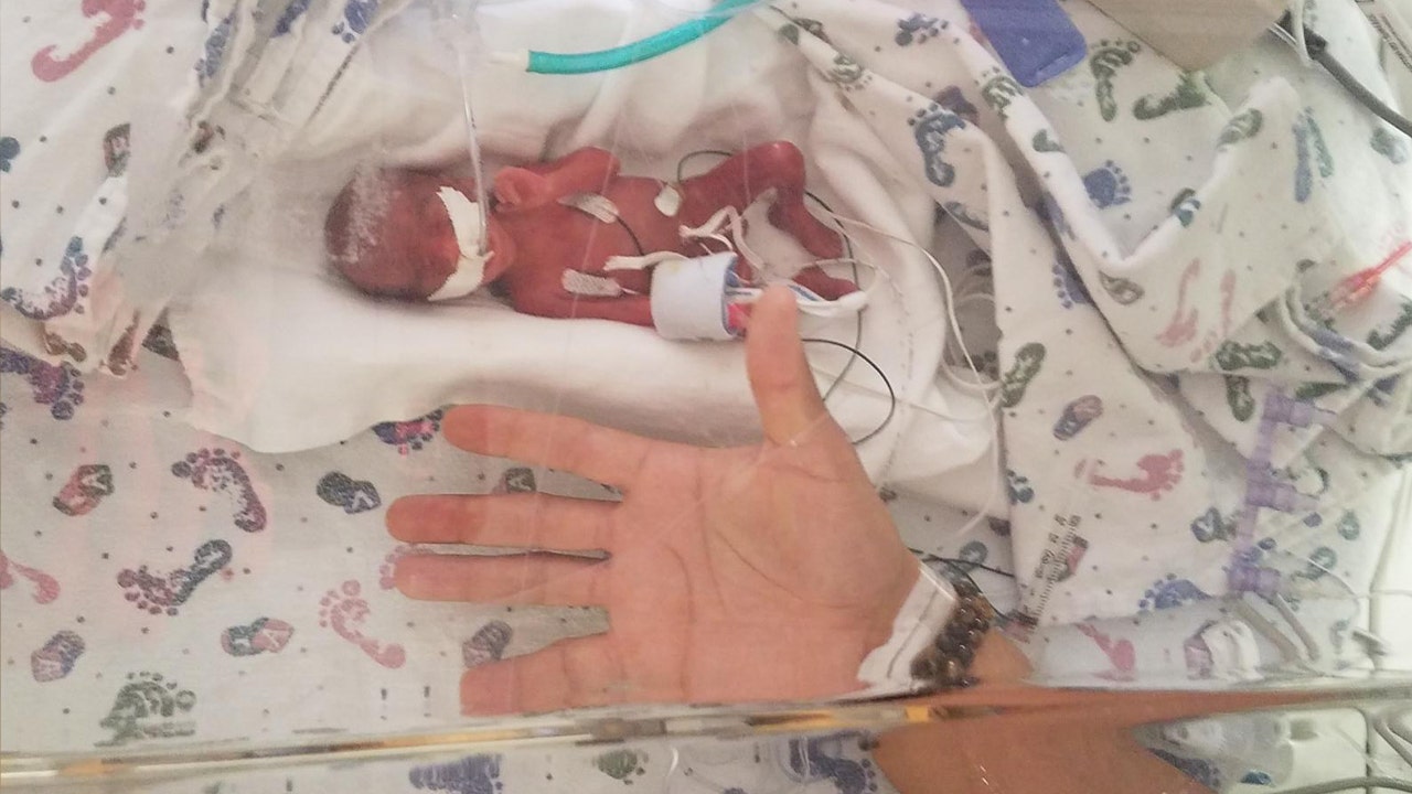‘Remarkable' Tiny baby born weighing just 13 ounces wows doctors with