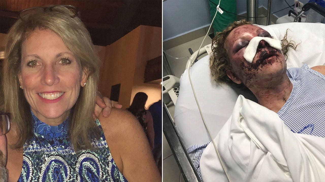 Woman shares terrifying story after being beaten for 8 hours allegedly