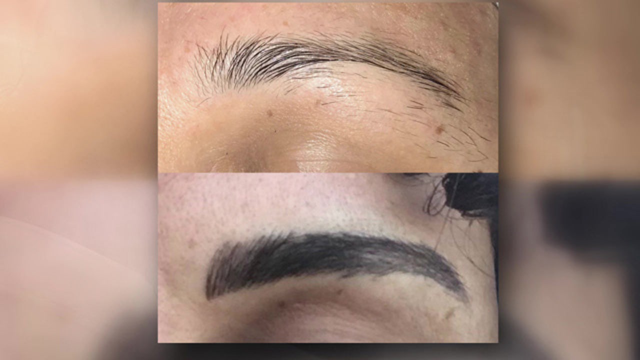 One woman shares her story of microblading gone wrong