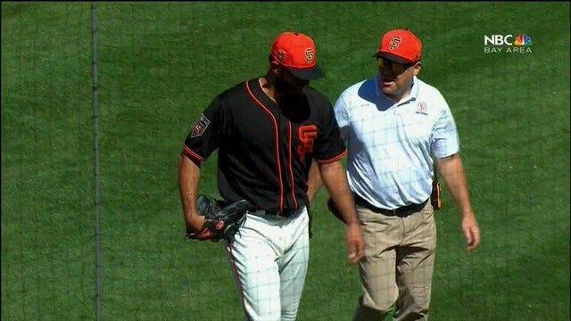 Bumgarner breaks pitching hand when hit by line drive