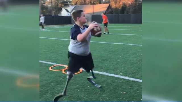 That Kid's Got Game: Teen born with no tibia bones trains to be pro quarterback
