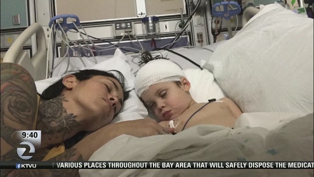 Community rallies behind 4-year-old Walnut Creek boy with rare brain tumor