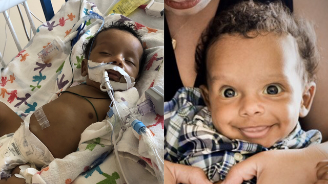 Mother desperately seeking liver transplant for her 4-month-old baby in the North Bay