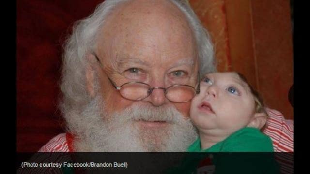 Boy born with partial skull meets Santa