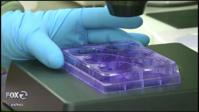 Trump administration plan to defund fetal tissue research impacts UCSF