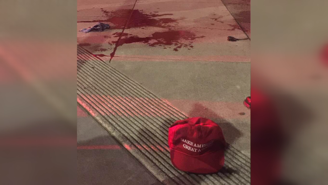 SF police search for MAGA hat-wearing man who allegedly sliced victim's hand with sword