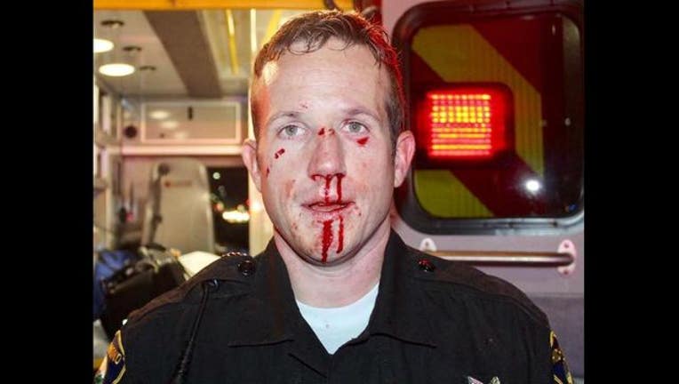 e98402ff-Richmond_officer_injured_1490885638714.JPG