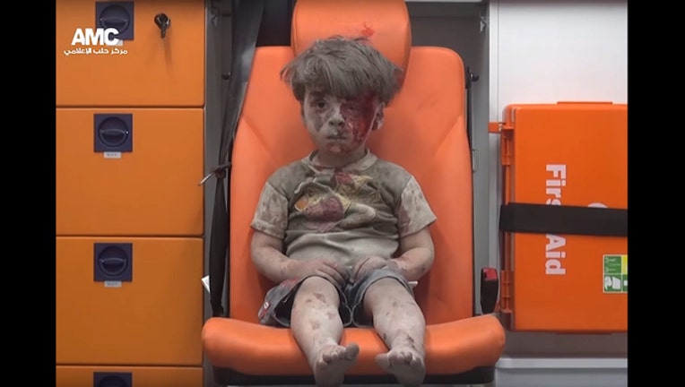 Injured boy from Aleppo_1471540173135