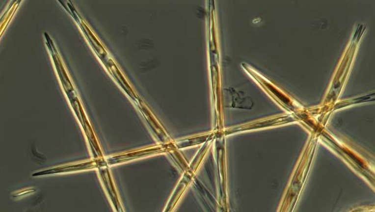 Toxic algae bloom