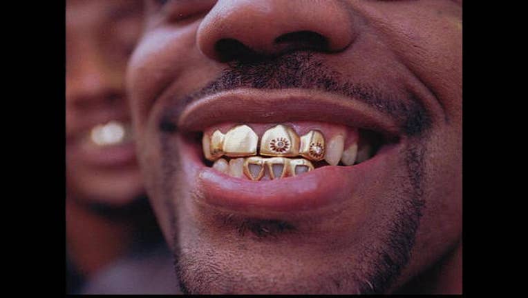 d4e79f45-goldteeth_1455942870232.jpg