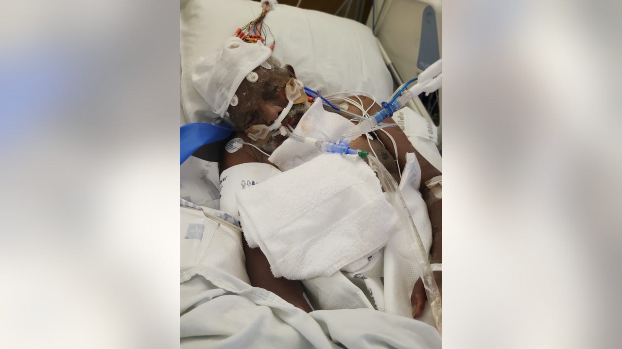 Solano Co. jail faces wrongful death claim for man's fatal allergic