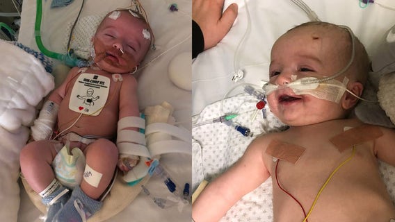 Baby defies doctors by waking up after 5-day coma, smiles at daddy
