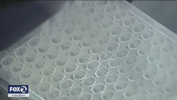 Bay Area laboratory assisting in the detection of coronavirus cases