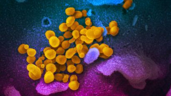 2 more cases of COVID-19 confirmed in Marin County