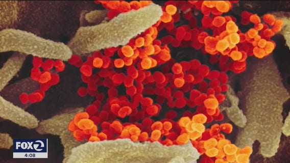 Teacher at Santa Clara County preschool tests positive for COVID-19