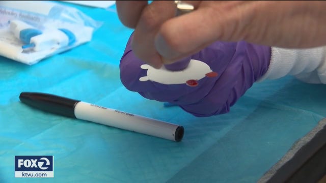 UC Berkeley scientists launch new coronavirus antibody test