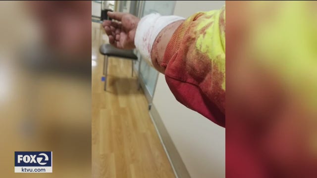 Truck driver hurt during Oakland protests supports cause, disappointed some turned violent