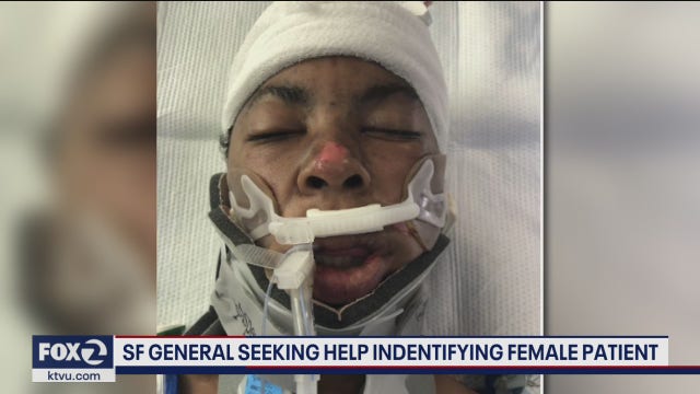 Zuckerberg San Francisco General Hospital seeks public's help identifying female patient