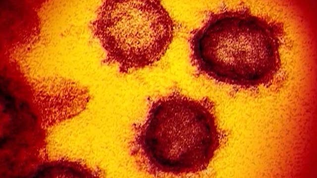 Over half of states in US report increase in COVID-19 cases, according to Johns Hopkins