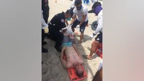 Santa Rosa man bit by shark while vacationing in Florida
