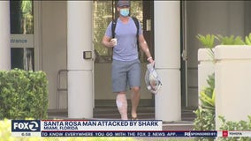 Santa Rosa man survives shark attack: 'Luckily it didn't hurt'