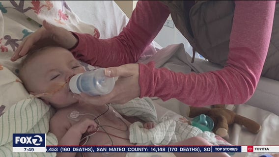 Toddler survives 12 hours of open-heart surgery at UCSF Benioff Children's Hospital