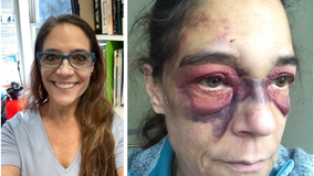 Grandma ends up bruised in Santa Rita Jail after calling 911 for help