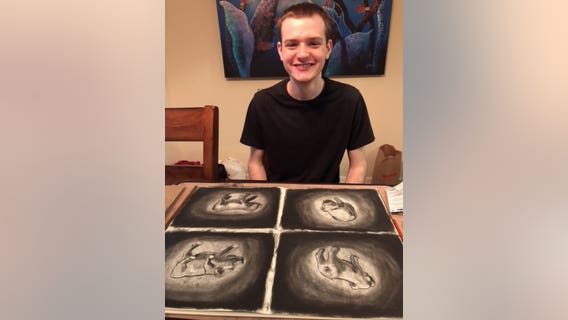 Santa Rosa police seek missing 18-year-old man with autism