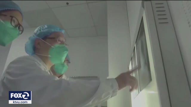 COVID variant outbreaks in Santa Clara County including Kaiser San Jose